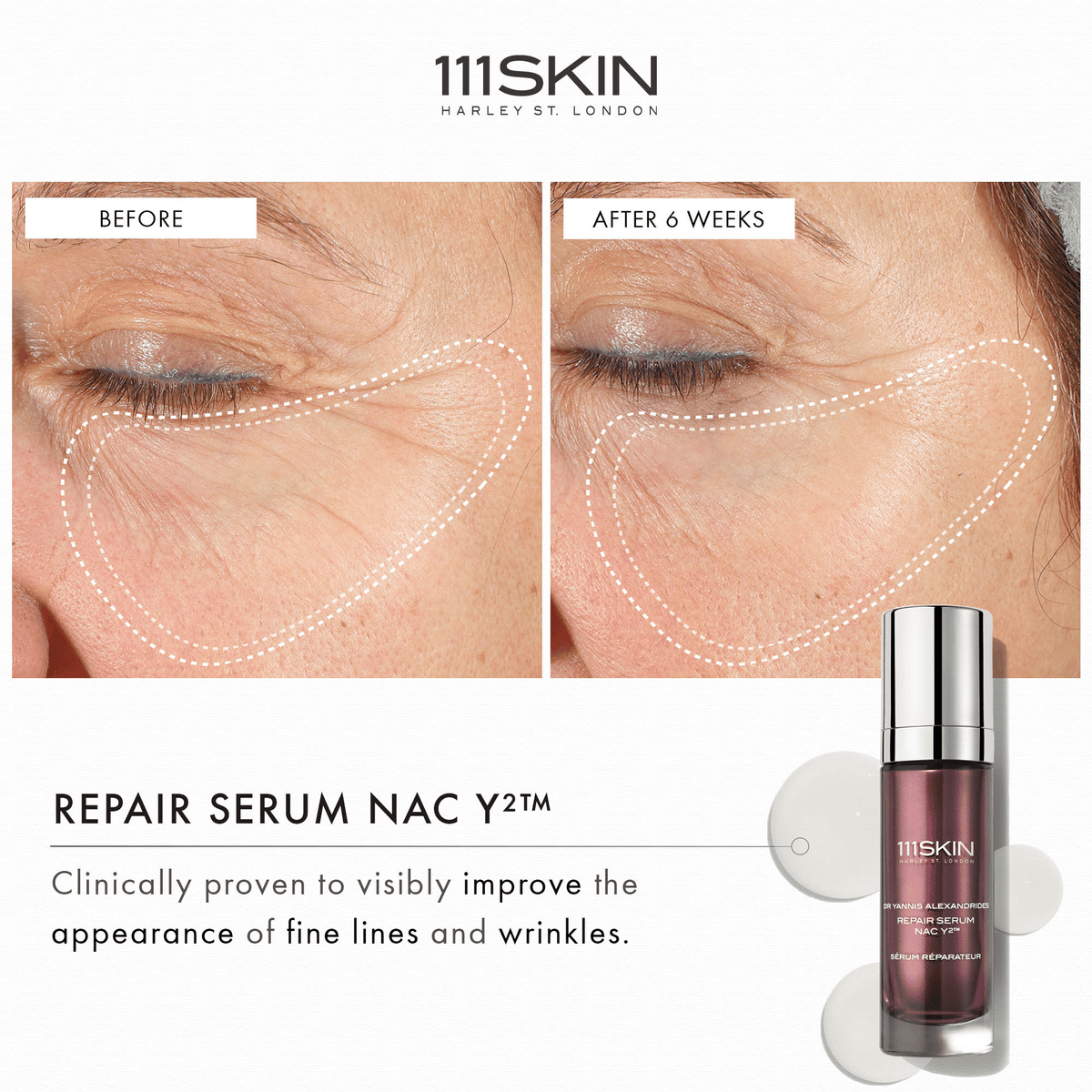 111SKIN Repair Serum NAC Y2