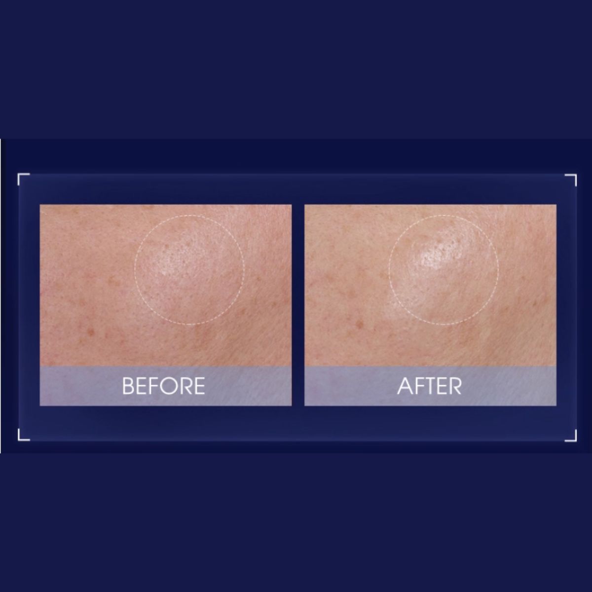 Pier Auge Soothing & Repair Essence Lotion 200ml