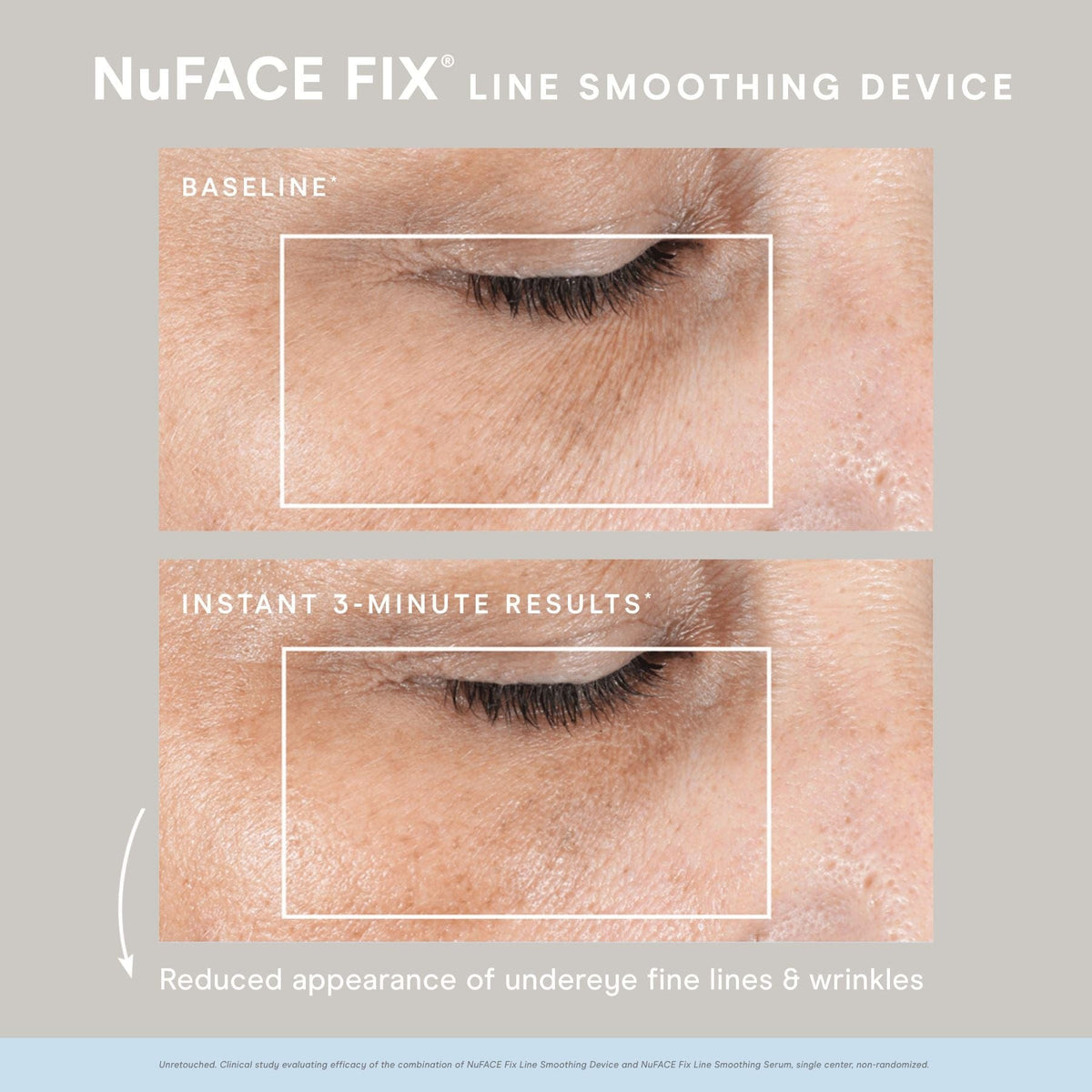 NuFACE FIX KIT