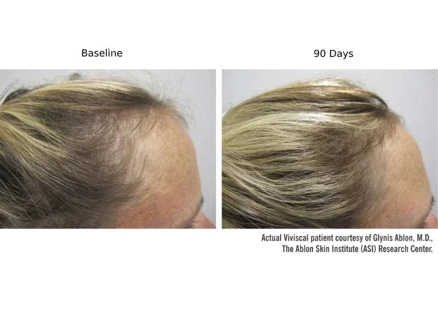 Viviscal PRO Hair Growth Supplement - 180 Tablets