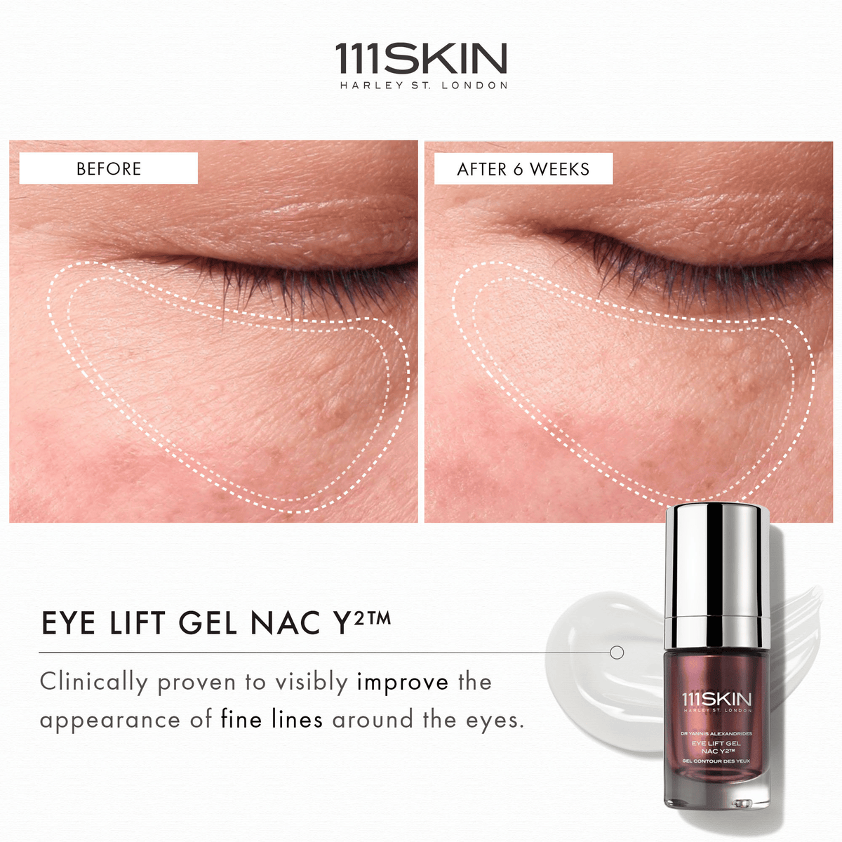 111SKIN Eye Lift Gel NAC Y2