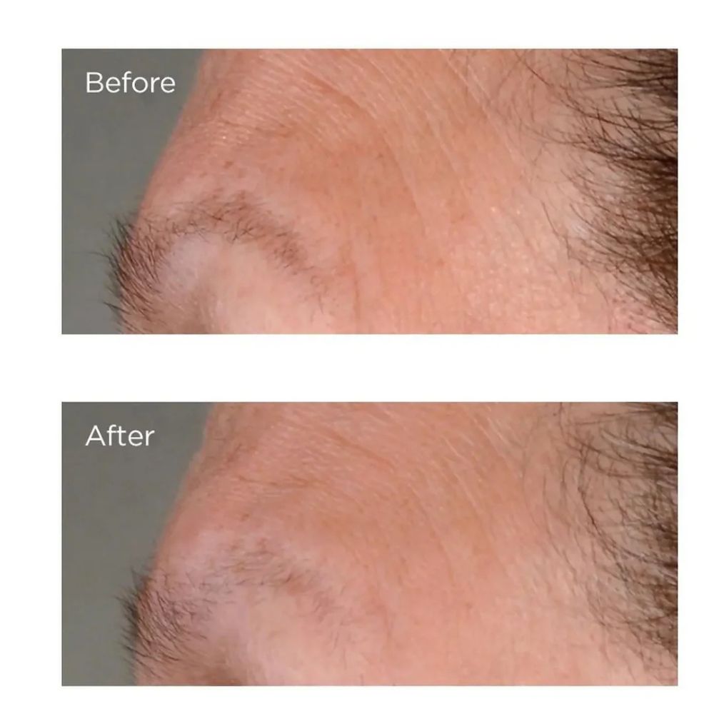 Perricone MD High Potency Growth Factor Firming & Lifting Serum