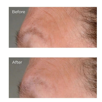 Perricone MD High Potency Growth Factor Firming & Lifting Serum