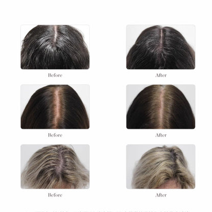 Larimide Kojaxin Stops Hair loss & Stimulates Growth Ampous (15 X 4ml)