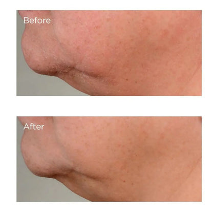 Perricone MD High Potency Growth Factor Firming & Lifting Serum