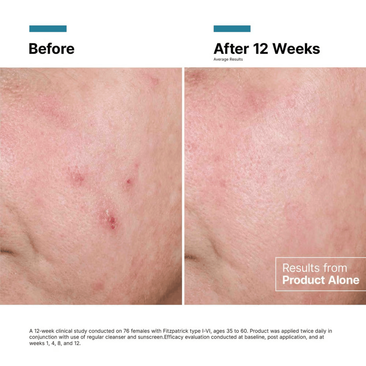SkinCeuticals Advanced RGN-6 50ml