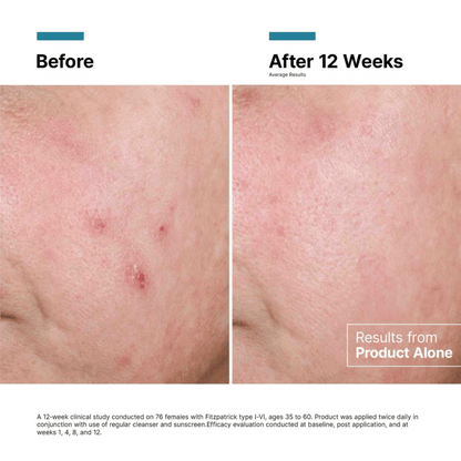 SkinCeuticals Advanced RGN-6 50ml
