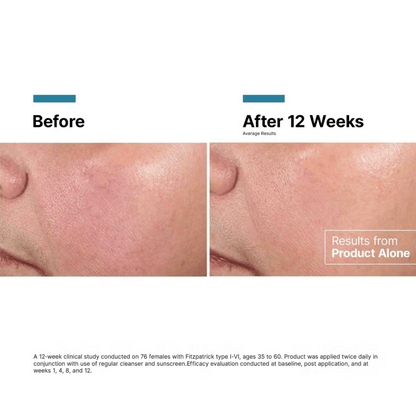 SkinCeuticals Advanced RGN-6 50ml