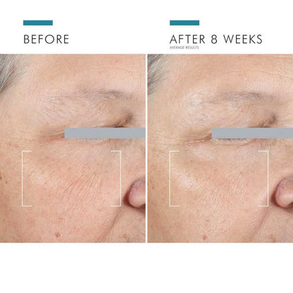 SkinCeuticals A.G.E Advanced Eye