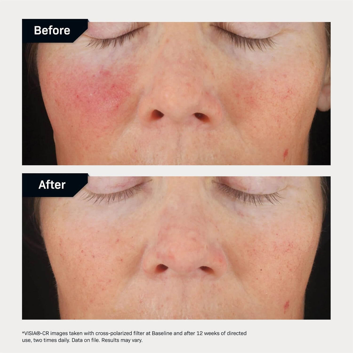 Revision Skincare C+ Correcting Complex 30% (2 x 15 ml)
