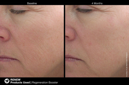 Jan Marini Regeneration Booster Face Lotion