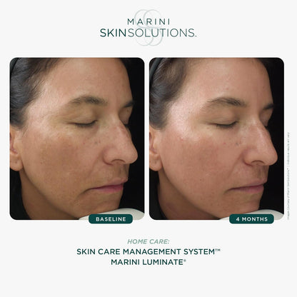 Marini Skin Solutions Marini Luminate Face Lotion