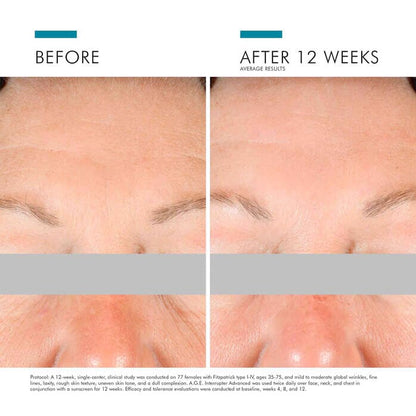 SkinCeuticals A.G.E Interrupter Advanced