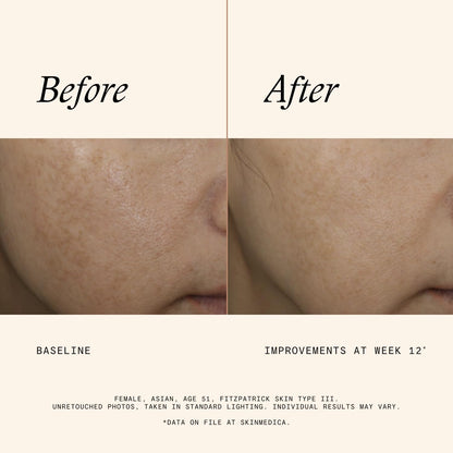 SkinMedica Even & Correct Advanced Brightening Treatment
