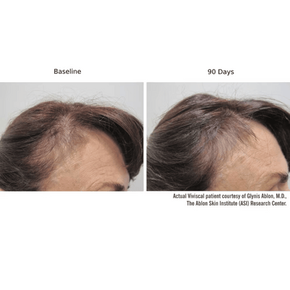 Viviscal PRO Hair Growth Supplement - 180 Tablets